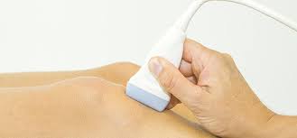 Sonographie Knie Sonographie Knie